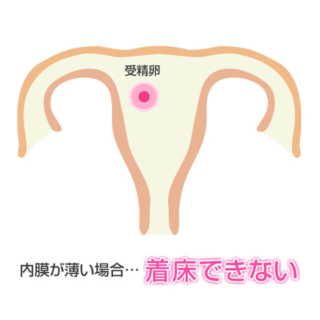 アフターピル（緊急避妊薬）で対応