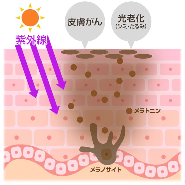 紫外線対策をしないと皮膚がんや光老化が発症するリスクが跳ね上がる