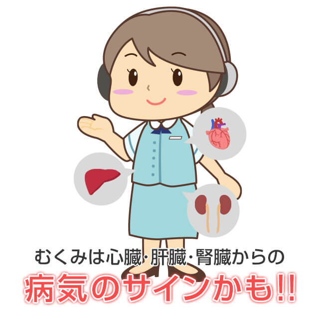 むくみは肝臓・腎臓・心臓の病気の可能性があるので放置は危険