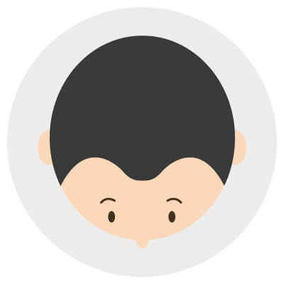 生え際から後頭部に向かって薄毛になるM字ハゲはAGAの中でも治療が難しい