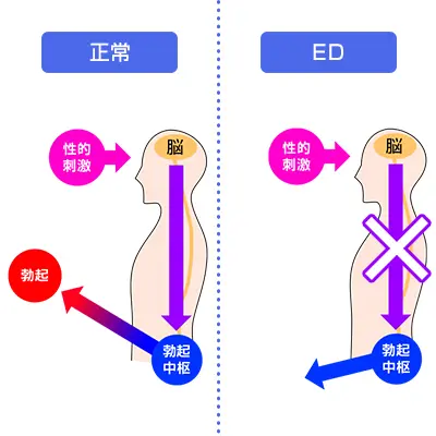 EDとは？
